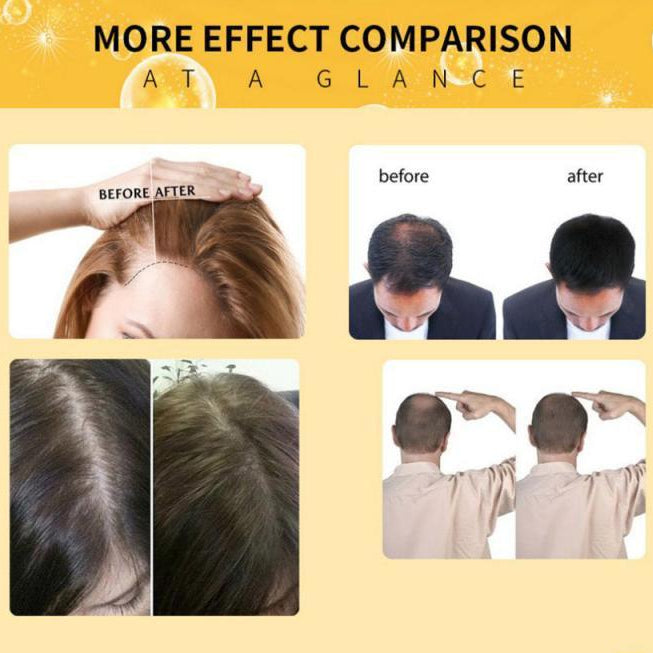 Hair Loss Prevention - Rapid & Natural Hair Growth