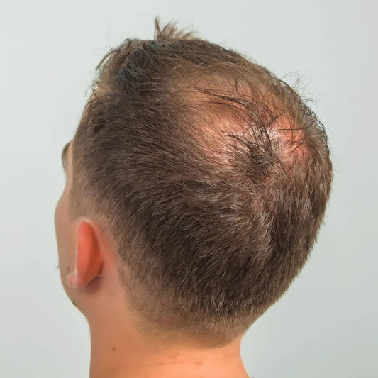 The best hair care routine for men with thinning hair