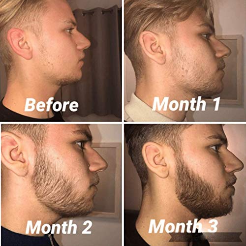 How to Use a Beard Growth Kit