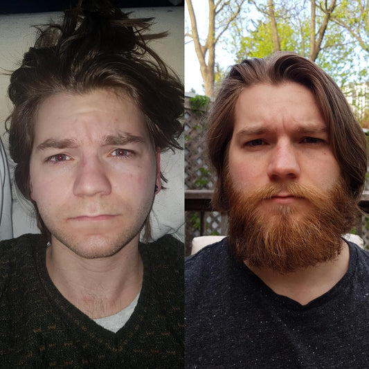 Beard Oil Before and After