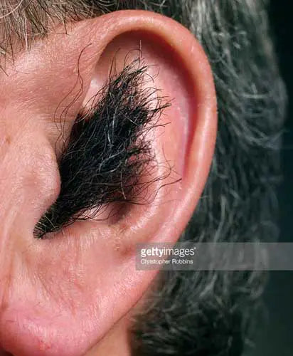Permanently Remove Ear Hair with Ease