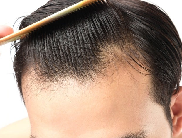 The Best Hair Care Products for Men with Thinning Hair